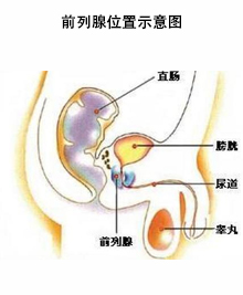 前列腺位置示意图